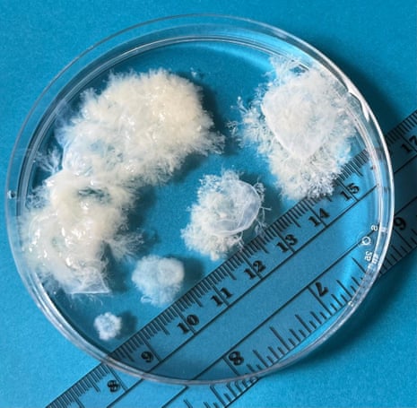 whitish material in petri dish