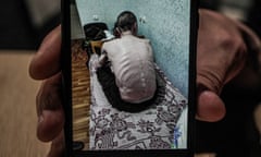 A hand holds a photograph up to the camera of a severely emaciated man sitting with his back to the camera on a bed