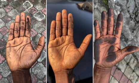Soot deposit on the hands of people living in Port Harcourt in south-east Nigeria.