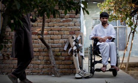 Abdul Wahid, 21, a soldier in the Afghan National Army, poses beside his prosthetic leg