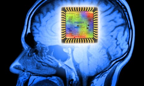 Computer chip superimposed on an MRI scan