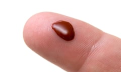 Blood on finger tip from a blood test pin prick
