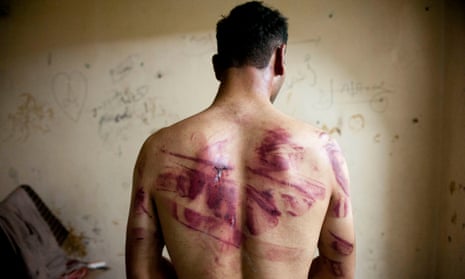 A man shows the wounds on his back.