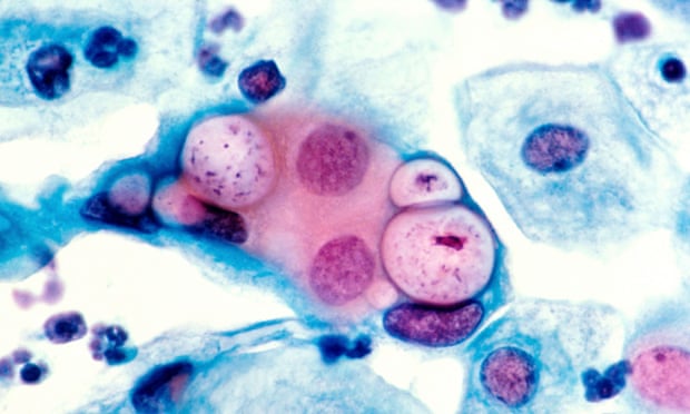 Closeup of chlamydia trachomatis bacterium