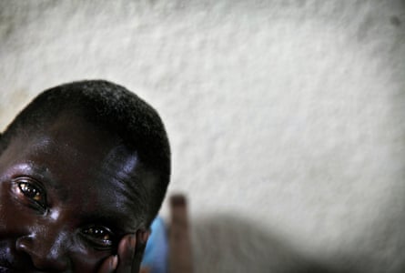 An African man with red eyes who looks as if he has been crying stares at the camera