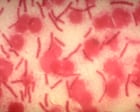 AI can fuel biological weapons. We must harness its power for defense | Annie Jacobsen AI can fuel biological weapons. We must harness its power for defense | Annie Jacobsen