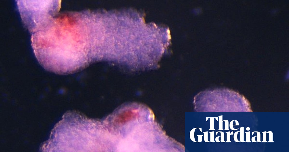 Lab-grown human embryo model produces blood cells