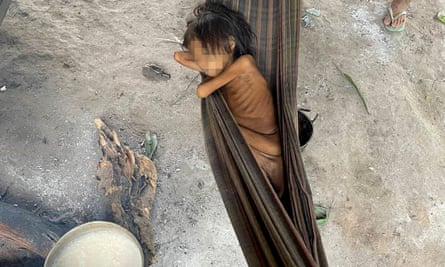 An emaciated Yanomami girl in Maimasi village, Roraima state, released by a Catholic missionary.