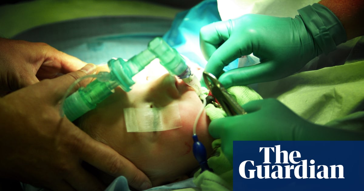 Hospital tooth extractions for children in England fall by over half in pandemic