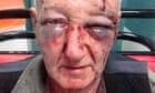 70-year-old beaten up after asking man to stop urinating against house