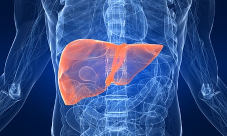 Sharp 80% rise in liver cancer deaths in UK | Cancer | The Guardian
