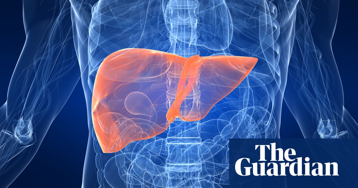 Hepatitis outbreak: what do we know about mystery cases in children?