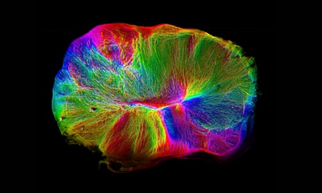 An image of the cerebral organoids grown from stem cells by Cambridge researchers.
