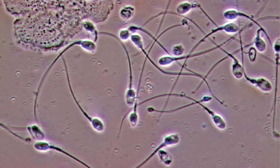 Human sperm.