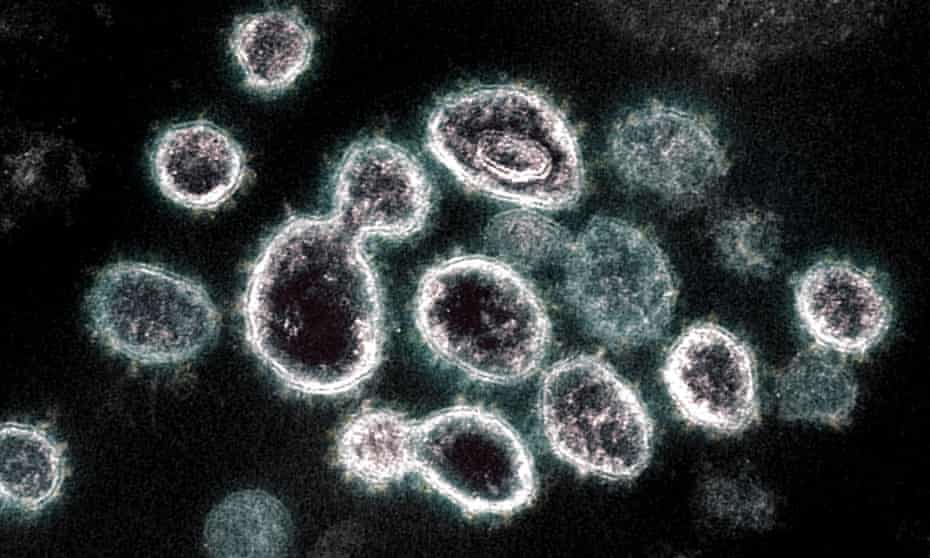 A transmission electron microscope image of Sars-CoV-2 virus particles emerging from the surface of cells cultured in a lab