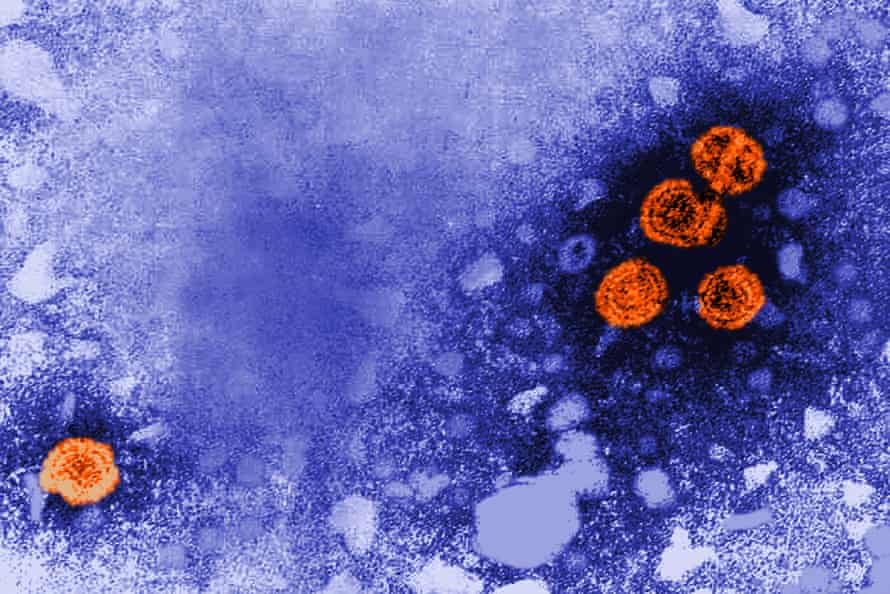 Hepatitis B virus particles under the microscope.