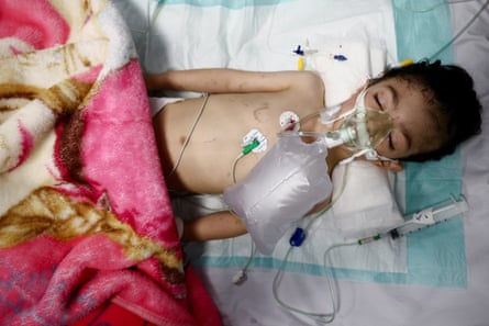 A young boy lying down attached to ventilation equipment