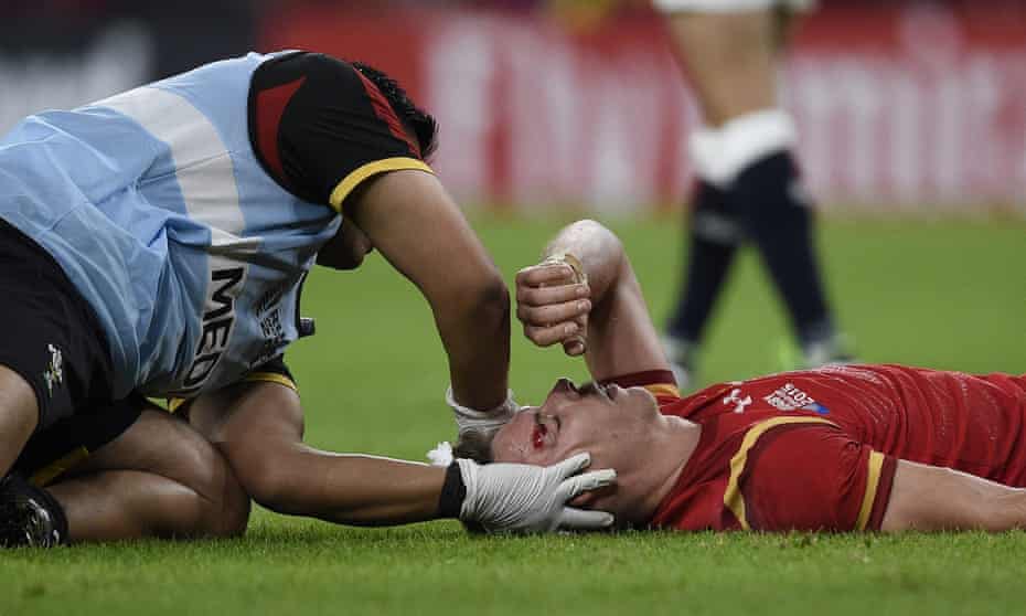 Wales May Ask For Tom Wood To Be Cited For Kick To Liam Williams Head Wales Rugby Union Team The Guardian Wales May Ask For Tom Wood To Be Cited For Kick To Liam Williams Head Wales Rugby Union Team The Guardian