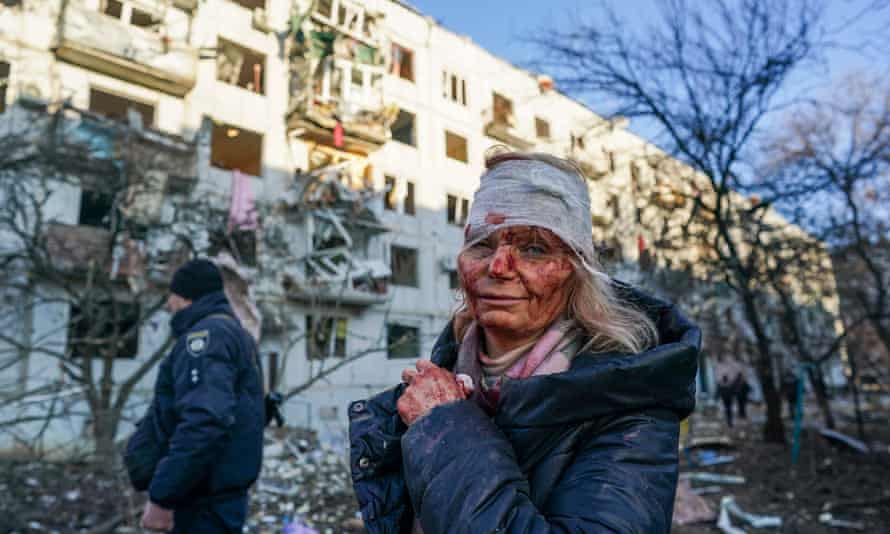 A wounded woman is seen after an airstrike damaged an apartment complex in city of Chuhuiv, Kharkiv Oblast, Ukraine.