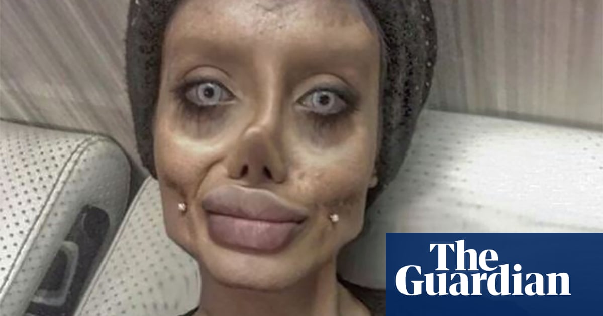 Sahar Tabar Iran Instagram Star Known For Plastic Surgery