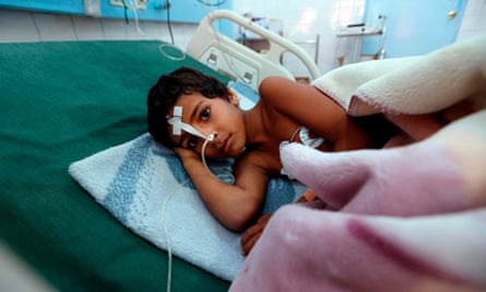 A Yemeni child suffering from diphtheria receives treatment at a hospital in the capital Sanaa.