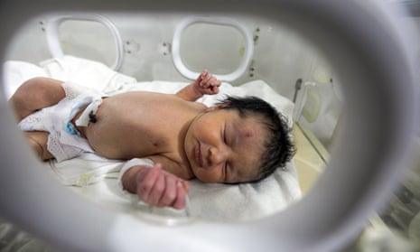 Baby Aya is treated in an incubator at a children's hospital in the city of Afrin, Syria.