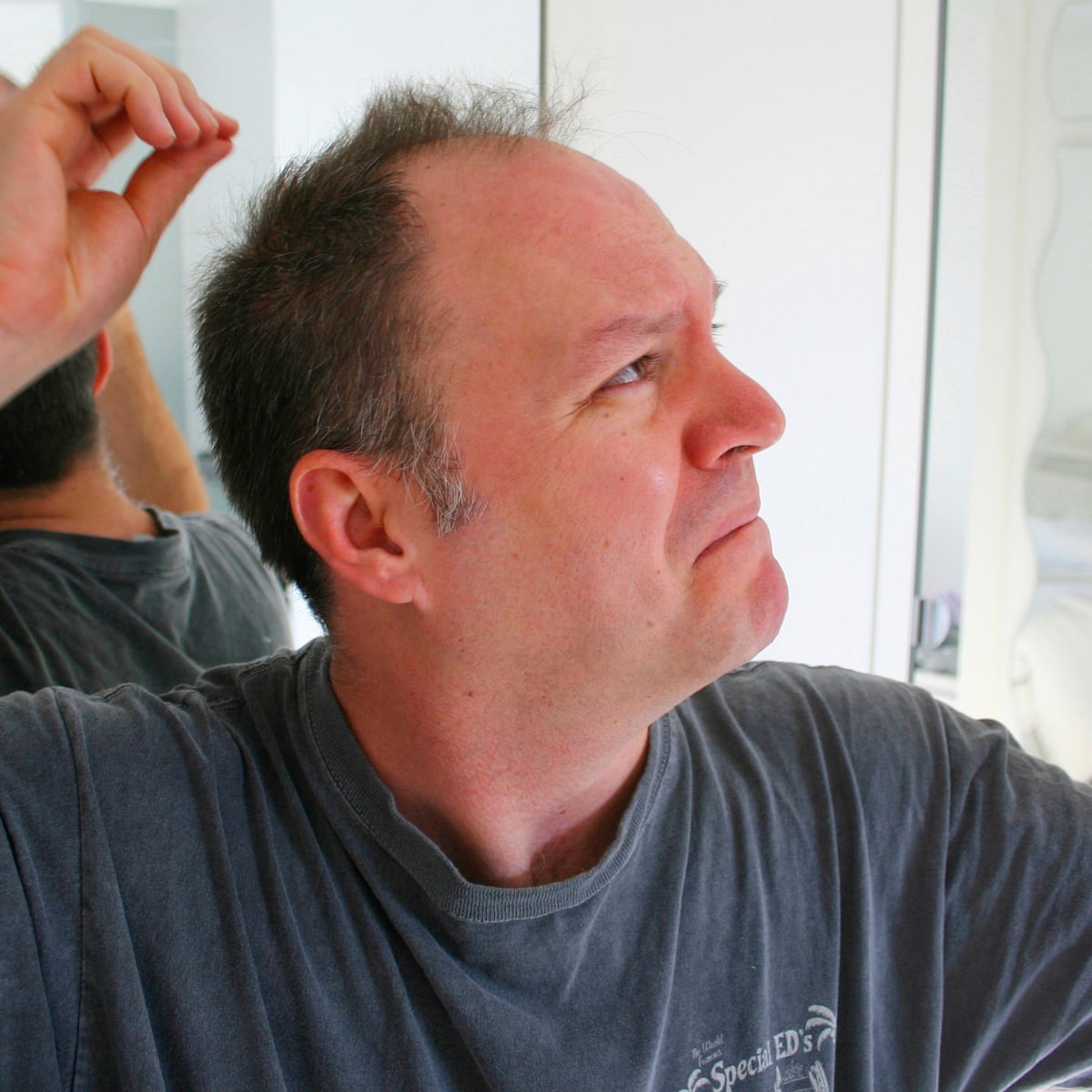 Seven Ways To Avoid Hair Loss Men S Hair The Guardian Seven Ways To Avoid Hair Loss Men S Hair The Guardian