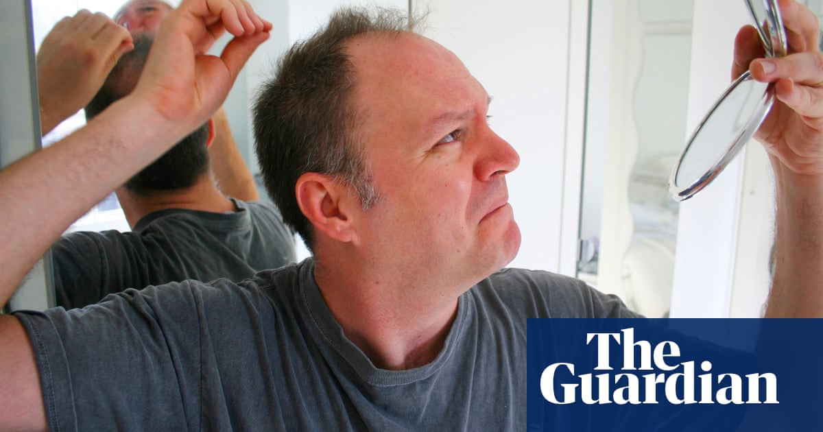 Seven Ways To Avoid Hair Loss Fashion The Guardian