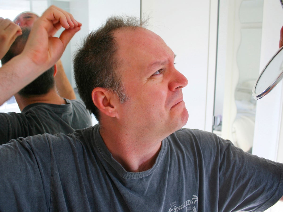 Seven ways  to avoid hair loss  Fashion  The Guardian Seven ways  to avoid hair loss  Fashion  The Guardian