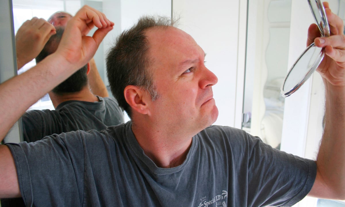 Seven ways … to avoid hair loss | Men's hair | The Guardian