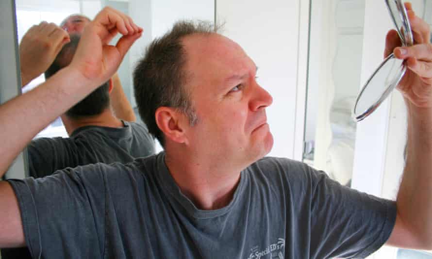 Seven Ways To Avoid Hair Loss Men S Hair The Guardian Seven Ways To Avoid Hair Loss Men S Hair The Guardian