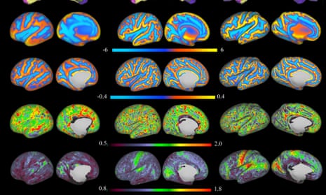 MRI brain scans of babies aged seven to nine months.