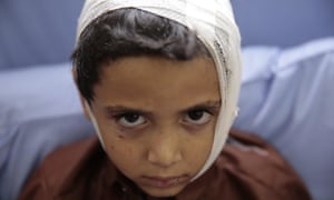 A child injured in the airstrike rests in hospital.