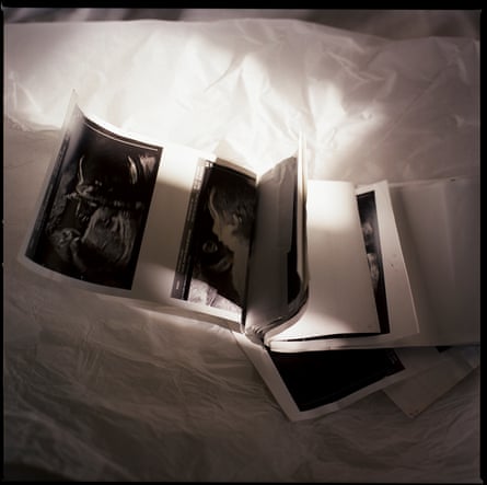Pregnancy scans on a bed.