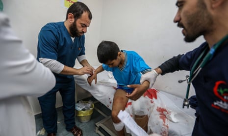 A Palestinian boy injured in Israeli air strikes is treated at Kuwait hospital in Rafah, on Wednesday.