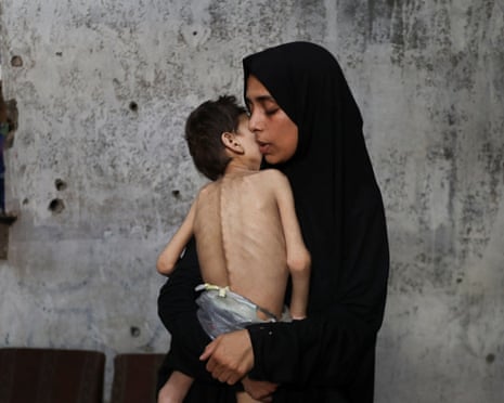 A displaced mother holding her visibly malnourished son