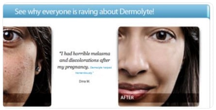 Shubnum Khan in an ad she appeared in, as a stock image model, for a skin treatment