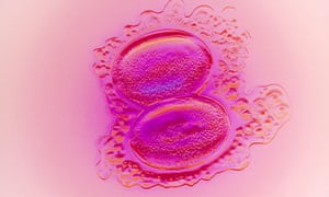 Transferring two embryos in IVF treatment can reduce success if one of them is of poorer quality, according to a new study
