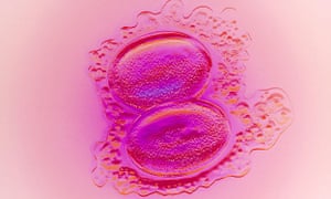 The Netherlands will change its laws on embryonic research, which until now only allowed tests to be conducted on leftover embryos procured from IVF.
