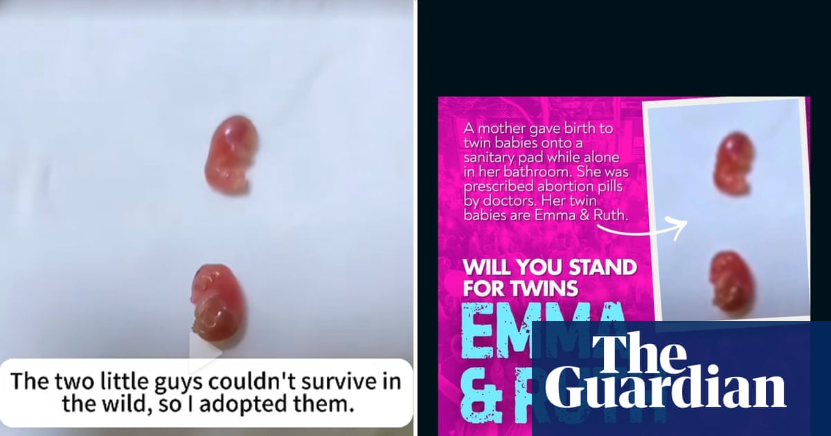 Image of ‘twin babies’ used by anti-abortion activist appears to show sugar gliders