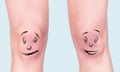 Someone's knees with faces drawn on, which are looking at each other through the corners of their eyes in comedic fashion.