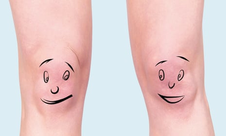 A pair of knees with faces drawn on, which are looking at each other through the corners of their eyes in comedic fashion.