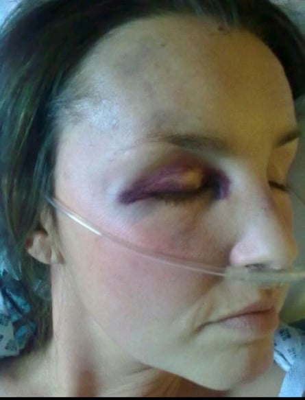 Rachel in hospital, after the shooting