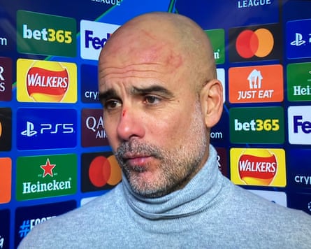 Manager City manager Pep Guardiola had several scratches on his head and a cut on the bridge of his nose which were visible when he was interviewed after Manchester City’s Champions League clash with Feyenoord on 26 November 2024.