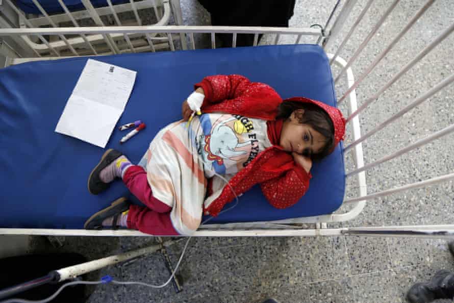 A child gets medical aid due to malnutrition at Al Sabeen Maternal Hospital, Yemen