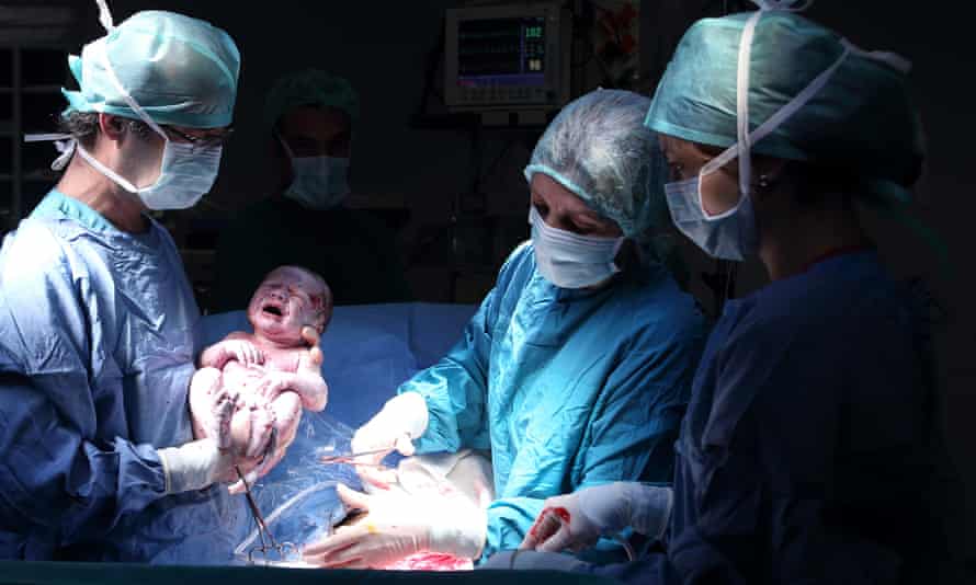A baby being born by caesarean