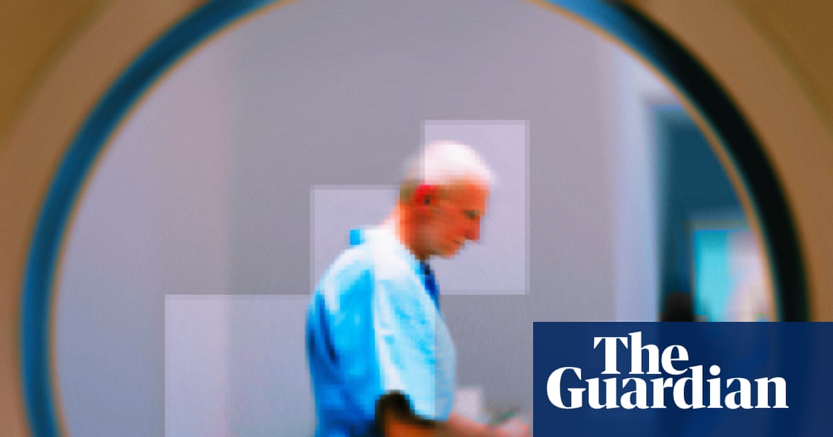 The silent epidemic: the pros and cons of screening for prostate cancer