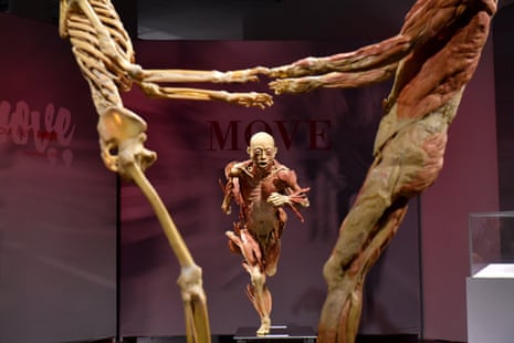 The corpses in the Real Bodies exhibition in Sydney are mostly from China, 