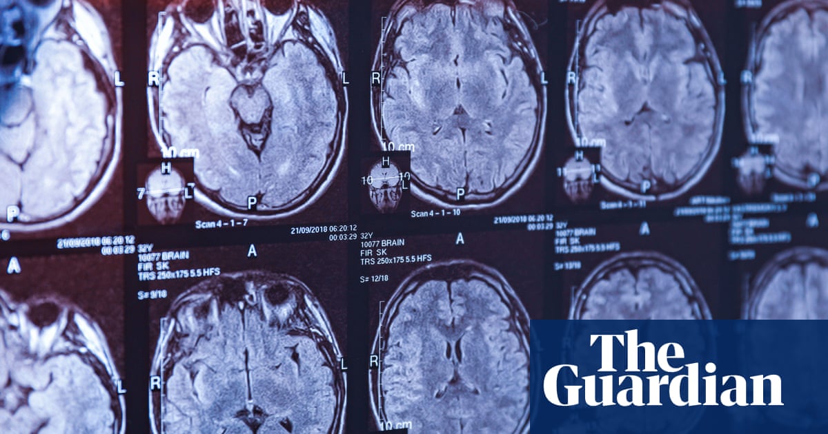 The latest twist in a Canadian medical mystery – podcast | Science The latest twist in a Canadian medical mystery – podcast | Science