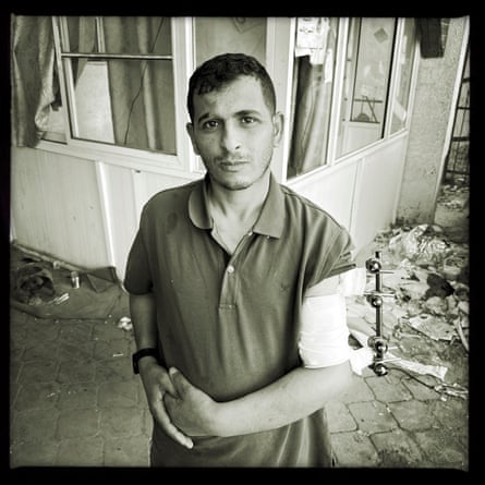 A patient in front of al-Amal hospital